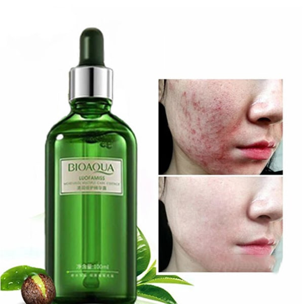 تصویر قبل و بعد از استفاده سرم چای سبز بیوآکوا